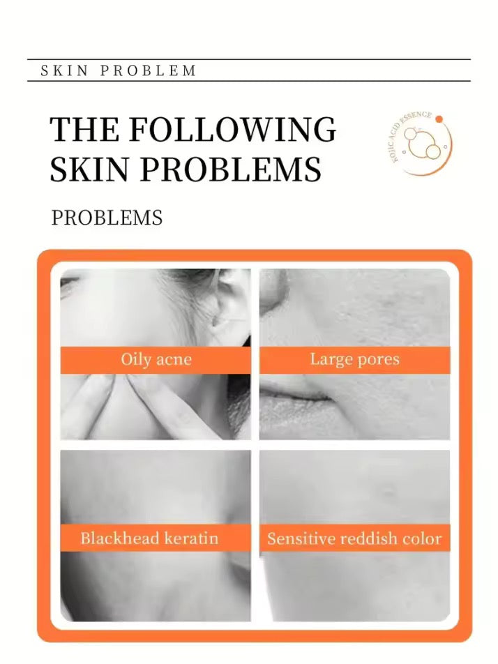 Kojic Acid Soap with Vitamin C,Turmeric, Retinol, Shea Butter & Vitamin E - Organic Skincare